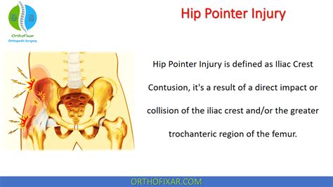 What is a Hip Pointer Injury in Football: A Deep Dive into the Painful Reality of Gridiron Warriors